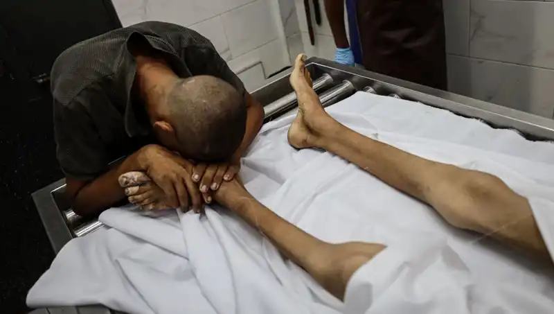 Gazze'deki Çocuklar Açlıkla Mücadele Ediyor: Bir Can Daha Kaybedildi
